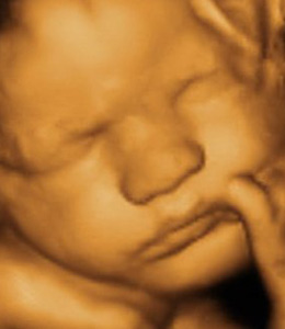 3D/4D Scan - Between 26 - 32 Weeks (Incl Gender and the Growth of the baby)